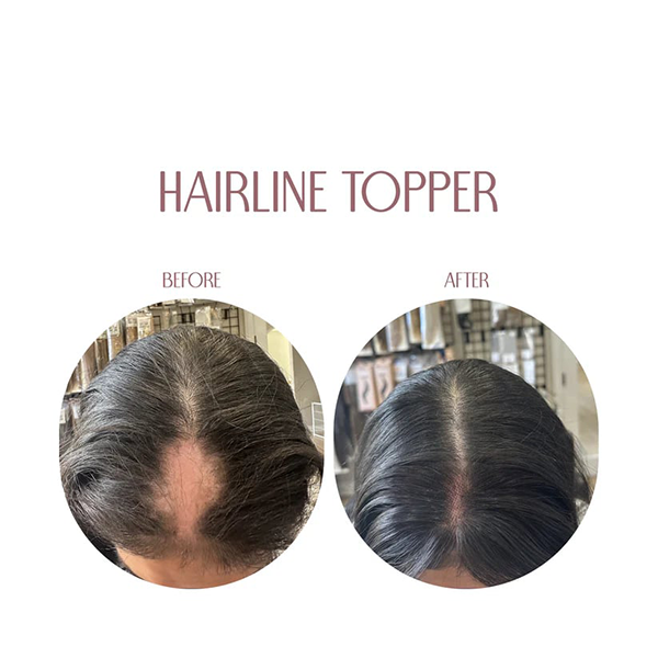 Hairline Band – Limitierter Bestand, verbessere deinen Look noch heute!🔥