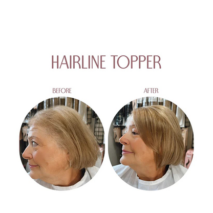 Hairline Band – Limitierter Bestand, verbessere deinen Look noch heute!🔥